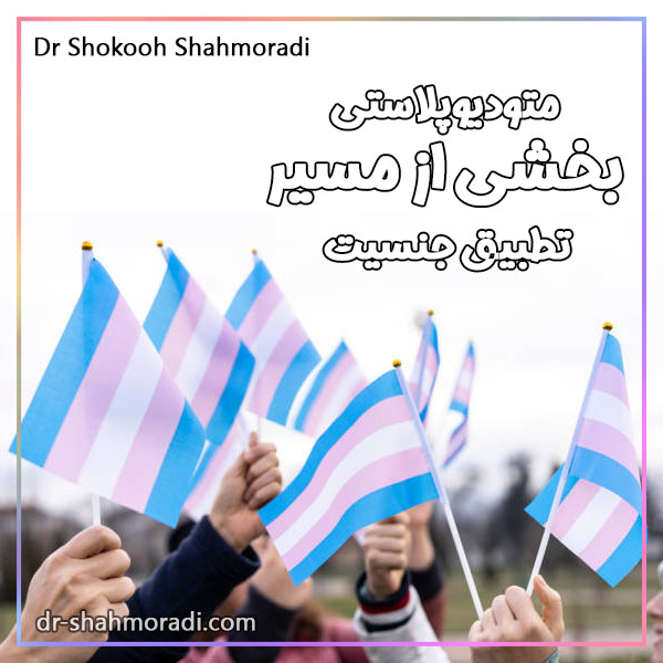 متودیوپلاستی جراحی تطبیق جنسیت - کتر شکوه شاهمرادی