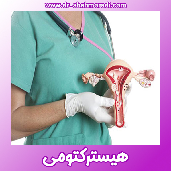 هیسترکتومی - https://dr-shahmoradi.com/