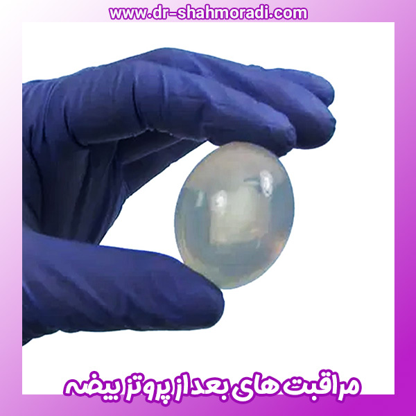 مراقبت های بعد از پروتز بیضه