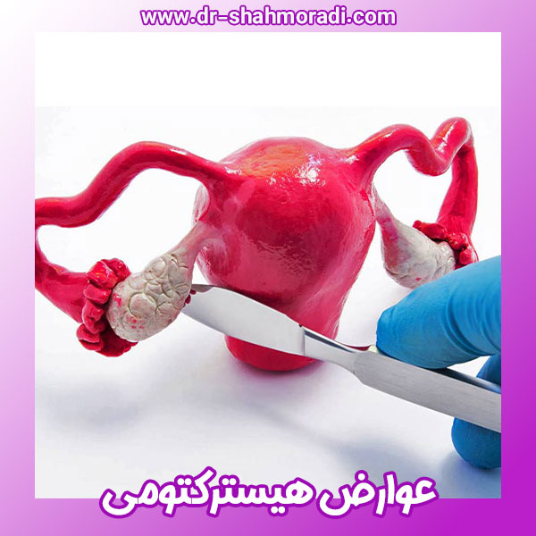 عوارض هیسترکتومی